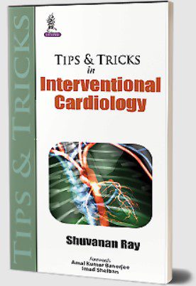 Tips & Tricks in Interventional Cardiology by Shuvanan Ray PDF Free Download