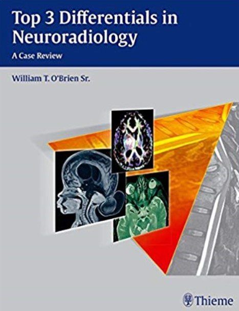 Top 3 Differentials in Neuroradiology PDF Free Download