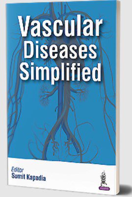 Vascular Diseases Simplified by Sumit Kapadia PDF Free Download