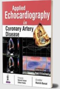 Applied Echocardiography in Coronary Artery Disease by Ravi R Kasliwal PDF Free Download