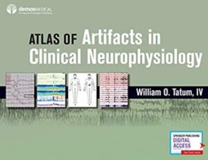 Atlas of Artifacts in Clinical Neurophysiology PDF Free Download