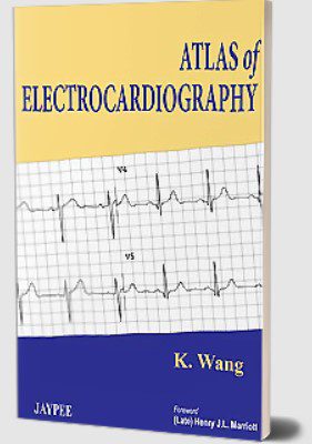 Atlas of Electrocardiography by K Wang PDF Free Download