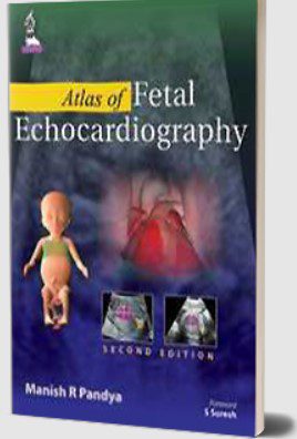 Atlas of Fetal Echocardiography by Manish R Pandya PDF Free Download