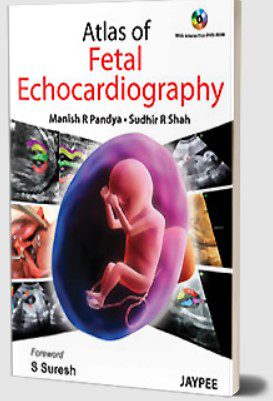 Atlas of Fetal Echocardiography by Sudhir R Shah PDF Free Download