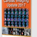 Cardiac Imaging Update 2017 by GN Mahapatra PDF Free Download