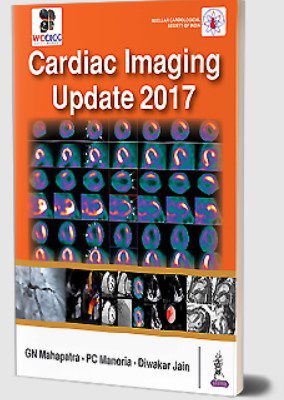 Cardiac Imaging Update 2017 by GN Mahapatra PDF Free Download