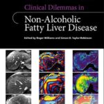 Clinical Dilemmas in Non-Alcoholic Fatty Liver Disease PDF Free Download