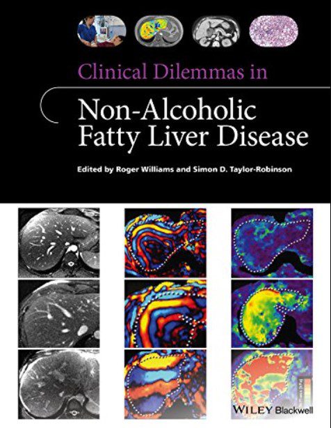 Clinical Dilemmas in Non-Alcoholic Fatty Liver Disease PDF Free Download