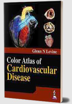 Color Atlas of Cardiovascular Disease by Glenn N Levine PDF Free Download