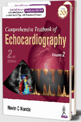 Comprehensive Textbook of Echocardiography by Navin C Nanda PDF Free Download