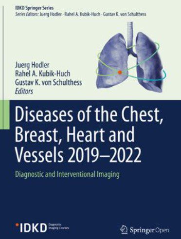 Diseases of the Chest, Breast, Heart and Vessels 2019-2022 PDF Free Download