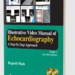 Download Illustrative Video Manual of Echocardiography: A Step by Step Approach (Part I) PDF Free