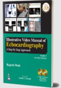 Download Illustrative Video Manual of Echocardiography: A Step by Step Approach (Part I) PDF Free