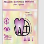 Download Management of Dental Caries Through the Atraumatic Restorative Treatment (ART) Approach PDF Free