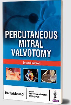 Download Percutaneous Mitral Valvotomy by Harikrishnan S PDF Free