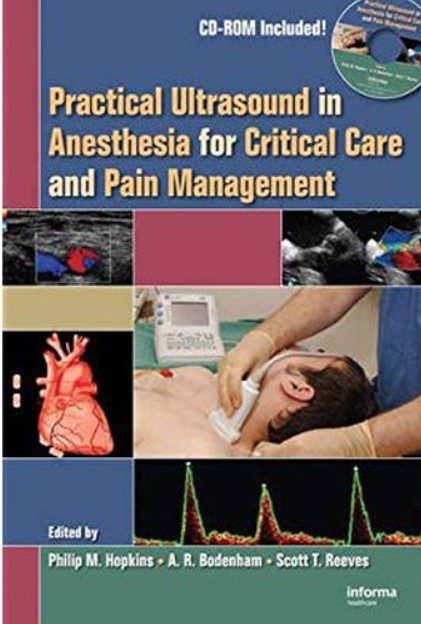 Download Practical Ultrasound in Anesthesia for Critical Care and Pain Management PDF Free