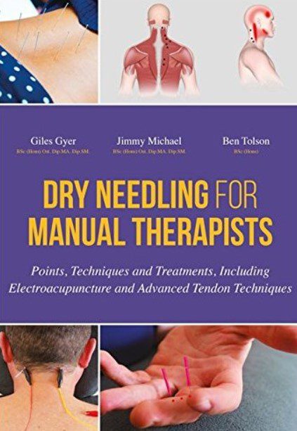 Dry Needling for Manual Therapists PDF Free Download