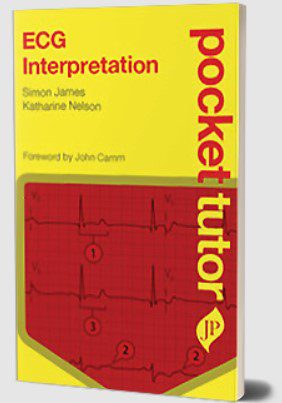 ECG Interpretation by Simon James PDF Free Download