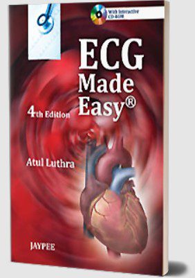 ECG Made Easy 4th Edition by Atul Luthra PDF Free Download