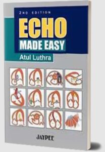 Echo Made Easy by Atul Luthra PDF Free Download