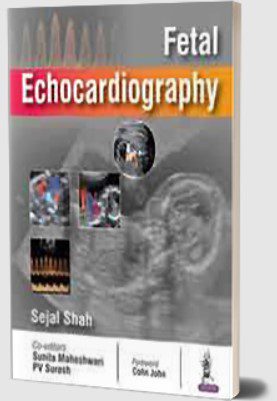 Fetal Echocardiography by Sejal Shah PDF Free Download