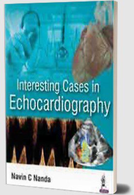 Interesting Cases in Echocardiography by Navin C Nanda PDF Free Download