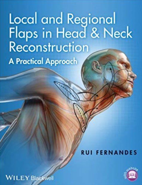Local and Regional Flaps in Head and Neck Reconstruction PDF Free Download