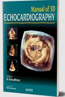 Manual of 3D Echocardiography by V Amuthan PDF Free Download