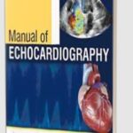 Manual of Echocardiography by Navin C Nanda PDF Free Download