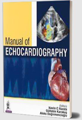 Manual of Echocardiography by Navin C Nanda PDF Free Download