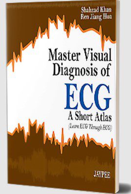 Master Visual Diagnosis of ECG by Shahzad Khan PDF Free Download