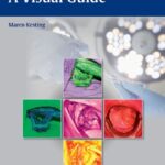 Oral Cancer Surgery: A Visual Guide PDF Free Download