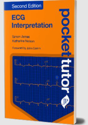 Pocket Tutor ECG Interpretation by Simon James PDF Free Download