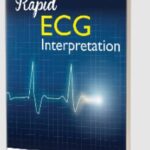 Rapid ECG Interpretation by M Gabriel Khan PDF Free Download