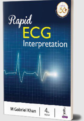 Rapid ECG Interpretation by M Gabriel Khan PDF Free Download