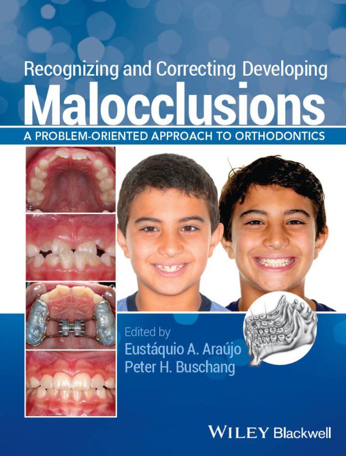 Recognizing and Correcting Developing Malocclusions PDF Free Download