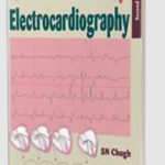 Textbook of Clinical Electrocardiography by SN Chugh PDF Free Download