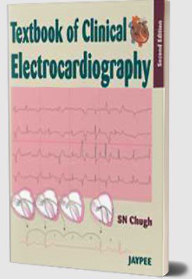 Textbook of Clinical Electrocardiography by SN Chugh PDF Free Download