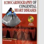 Transesophageal Echocardiography of Congenital Heart Diseases PDF Free Download