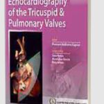 Transesophageal Echocardiography of the Tricuspid & Pulmonary Valves PDF Free Download
