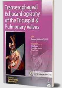 Transesophageal Echocardiography of the Tricuspid & Pulmonary Valves PDF Free Download
