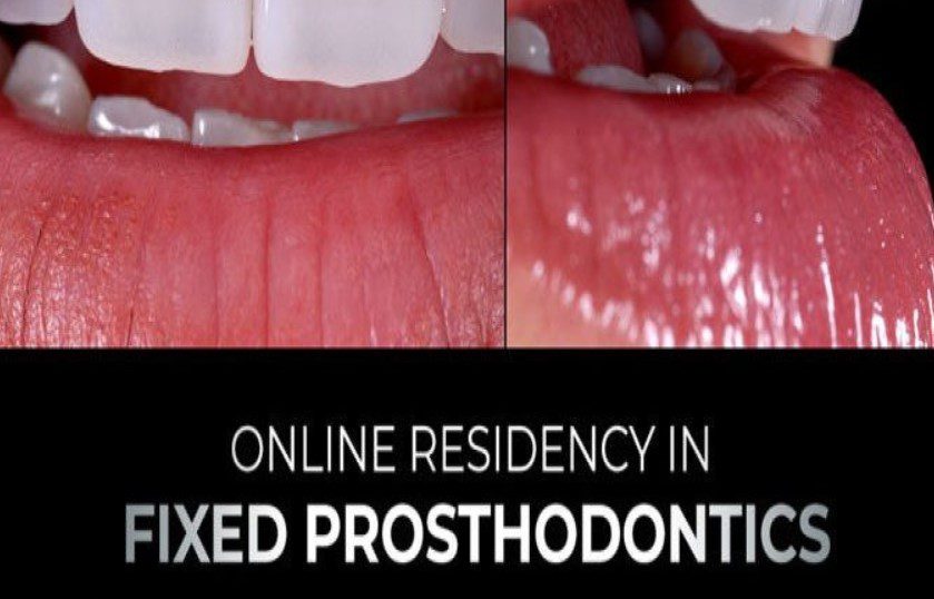 gIDEdental Online Residency Program in Fixed Prosthodontics Videos Free Download