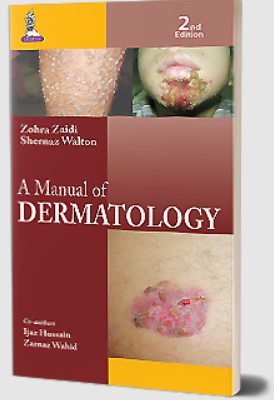A Manual of Dermatology by Shernaz Walton PDF Free Download