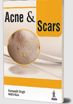 Acne & Scars by Ramanjit Singh PDF Free Download