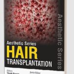 Aesthetic Series - Hair Transplantation by Marc R Avram PDF Free Download