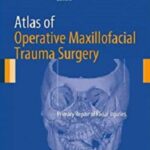 Atlas of Operative Maxillofacial Trauma Surgery PDF Free Download