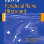 Atlas of Peripheral Nerve Ultrasound PDF Free Download