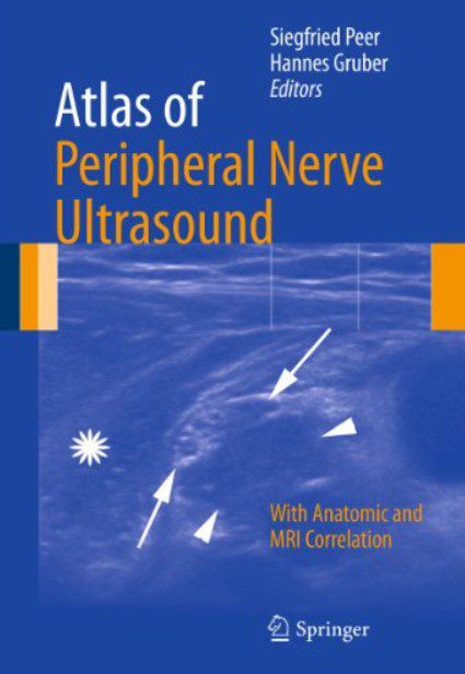 Atlas of Peripheral Nerve Ultrasound PDF Free Download