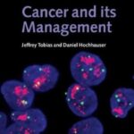 Cancer and its Management 6th Edition PDF Free Download