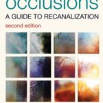 Chronic Total Occlusions: A Guide to Recanalization 2nd Edition PDF Free Download